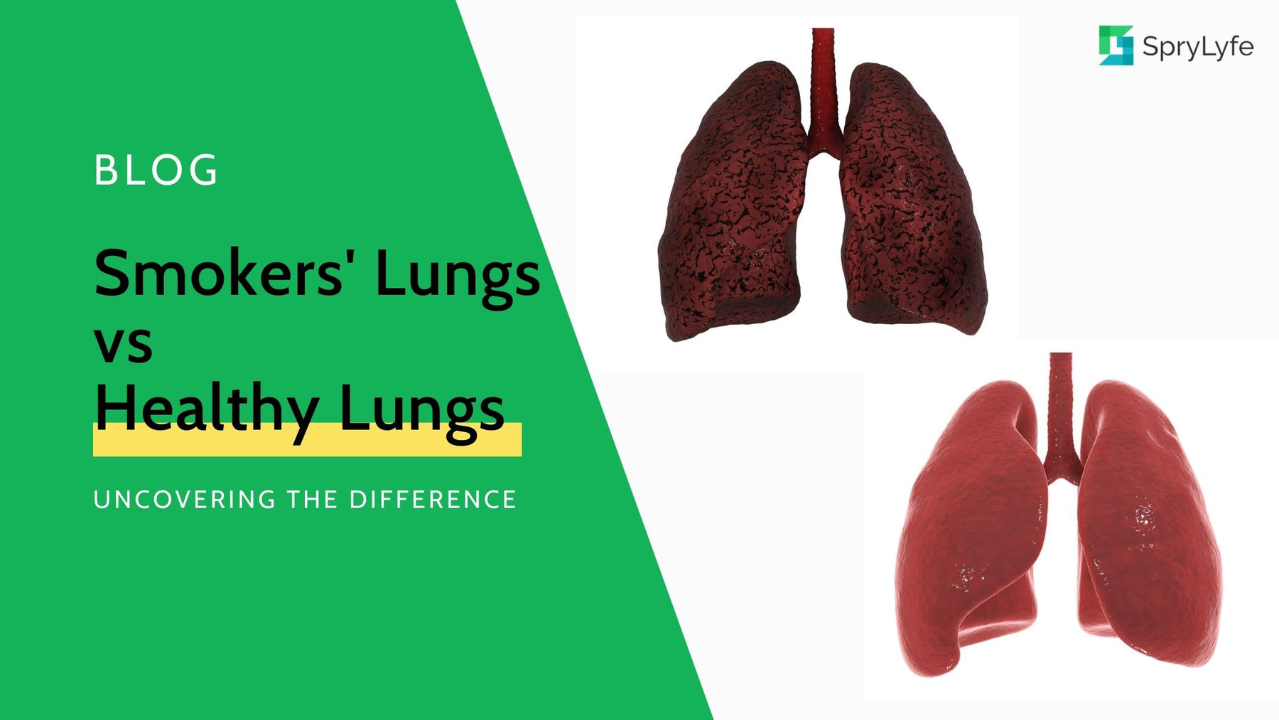 Uncovering the Difference: Smokers' Lungs vs Healthy Lungs